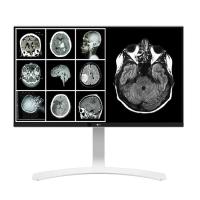 LG 27" IPS 27HJ712C_W 14MS HDMI Klinik İnceleme Monitörü 3840X2160