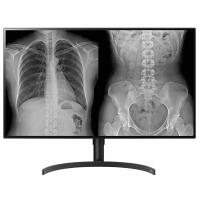 LG 31.5" IPS 32HL512D-B 8MP Teşhis Monitörü 3840X2160